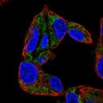 CYP27A1 Polyclonal Antibody