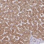 CYP27A1 Antibody in Immunohistochemistry (Paraffin) (IHC (P))