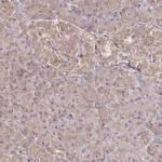 CYP27A1 Antibody in Immunohistochemistry (Paraffin) (IHC (P))