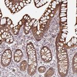 CYP27A1 Antibody in Immunohistochemistry (Paraffin) (IHC (P))