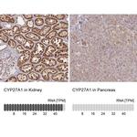 CYP27A1 Antibody in Immunohistochemistry (IHC)