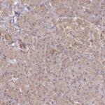 CYP27A1 Antibody in Immunohistochemistry (IHC)