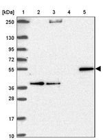 CYP27A1 Antibody in Western Blot (WB)
