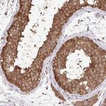 C12orf57 Polyclonal Antibody