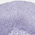 TBC1D29 Polyclonal Antibody