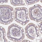 TMEM219 Antibody in Immunohistochemistry (IHC)