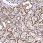 TMEM219 Antibody in Immunohistochemistry (IHC)