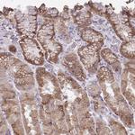 CHIA Polyclonal Antibody
