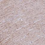 MYL12A Antibody in Immunohistochemistry (Paraffin) (IHC (P))