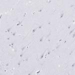 NOLA3 Antibody in Immunohistochemistry (Paraffin) (IHC (P))