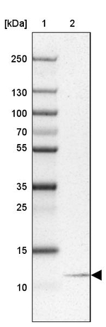 NOLA3 Antibody in Western Blot (WB)