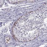 C3orf22 Antibody in Immunohistochemistry (IHC)