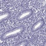 C3orf22 Antibody in Immunohistochemistry (IHC)