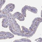 FOXN3 Antibody in Immunohistochemistry (Paraffin) (IHC (P))