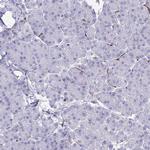 FOXN3 Antibody in Immunohistochemistry (Paraffin) (IHC (P))