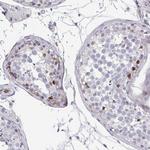 FOXN3 Antibody in Immunohistochemistry (Paraffin) (IHC (P))