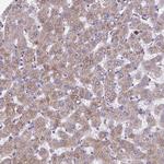 NIPSNAP1 Polyclonal Antibody