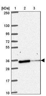 NIPSNAP1 Antibody in Western Blot (WB)