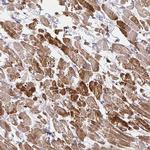SKA2 Antibody in Immunohistochemistry (Paraffin) (IHC (P))
