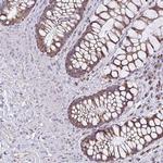 ZNF362 Antibody in Immunohistochemistry (Paraffin) (IHC (P))