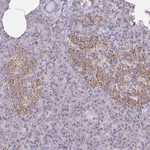 ZNF362 Antibody in Immunohistochemistry (Paraffin) (IHC (P))