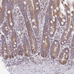 ZNF362 Antibody in Immunohistochemistry (Paraffin) (IHC (P))