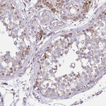 ZNF362 Antibody in Immunohistochemistry (Paraffin) (IHC (P))