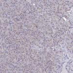 NDUFA7 Antibody in Immunohistochemistry (IHC)