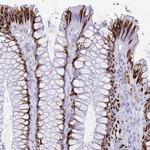 SELV Antibody in Immunohistochemistry (Paraffin) (IHC (P))