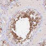 SYNGR4 Antibody in Immunohistochemistry (Paraffin) (IHC (P))