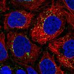 DTX4 Polyclonal Antibody