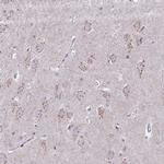 DTX4 Antibody in Immunohistochemistry (Paraffin) (IHC (P))