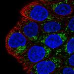 MAOA Polyclonal Antibody