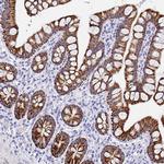 MAOA Antibody in Immunohistochemistry (IHC)