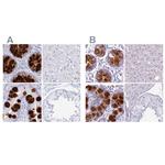 CLCA1 Antibody in Immunohistochemistry (IHC)