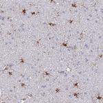 ASPH Polyclonal Antibody