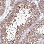 ZNF200 Antibody in Immunohistochemistry (Paraffin) (IHC (P))