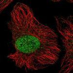 ZNF692 Polyclonal Antibody