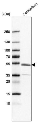 ZNF692 Antibody in Western Blot (WB)