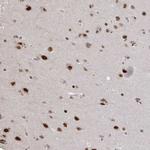ZDHHC12 Antibody in Immunohistochemistry (Paraffin) (IHC (P))