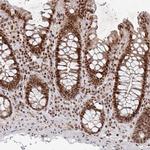 ZDHHC12 Antibody in Immunohistochemistry (Paraffin) (IHC (P))