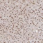ZDHHC12 Antibody in Immunohistochemistry (Paraffin) (IHC (P))