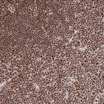 ZDHHC12 Polyclonal Antibody