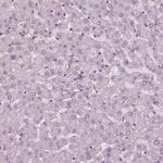 KRT79 Polyclonal Antibody