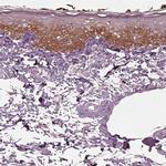 KRT79 Antibody in Immunohistochemistry (IHC)
