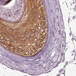 KRT79 Antibody in Immunohistochemistry (IHC)