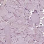 KRT79 Antibody in Immunohistochemistry (IHC)