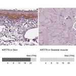 KRT79 Antibody