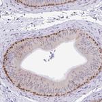 ZNF485 Polyclonal Antibody