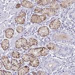 OR5F1 Polyclonal Antibody